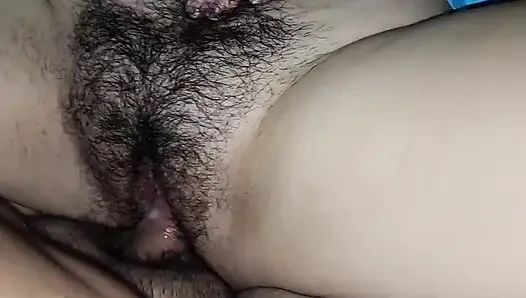 Hairy Teen