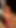 Yeni iç çamaşırımı beğendin mi? 👄