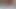 LizzyYum VR February 2024 Masturbation solo #3 Post Op Orgasm Pussy teasing