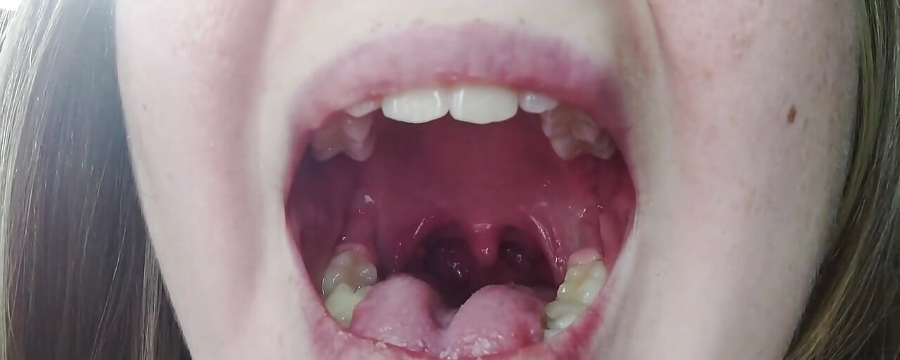 목구멍 페티쉬