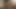 A young girl who has been sexually assaulted by a dildo