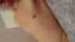 Pregled videozapisa