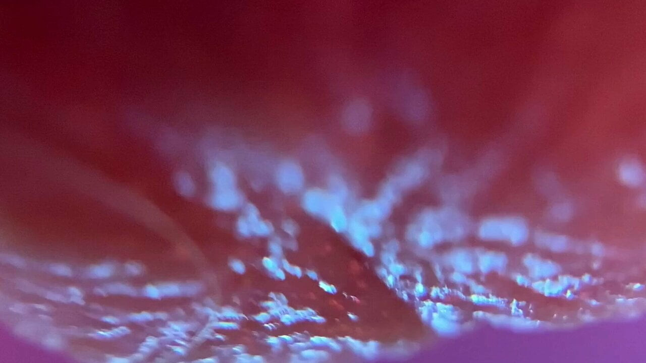 San u ružičastoj boji (izbliza)