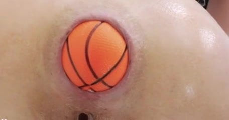 Hotkinkyjo