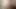 teaser