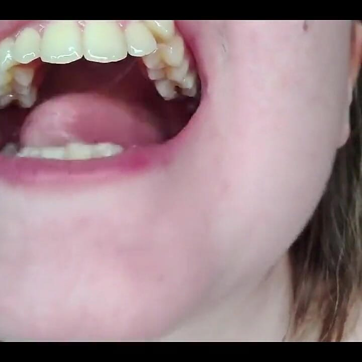 My Mouth, Teeth, Tongue and Throat up Close