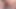 Peehole dilation urethra sounding and piss