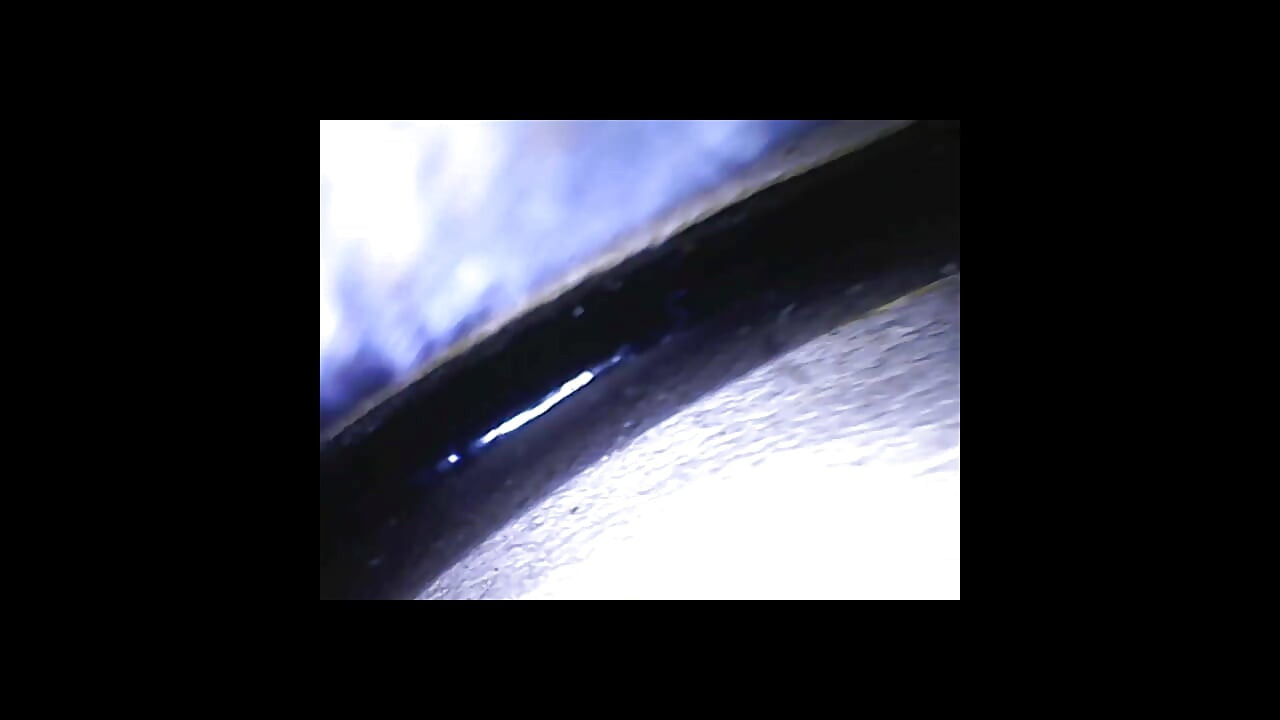 Speculum & Microcamera for Lady Soniac