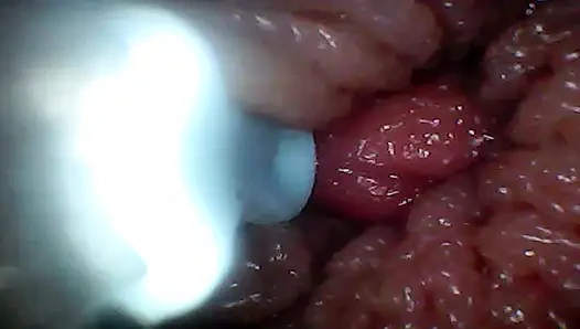 Экстремальная неуядность превращает наблюдателя в активного, голодного участника