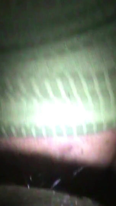 Ilaj njen dečko | Klip 1