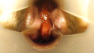 Espéculo anal e mostrando o interior do meu cu