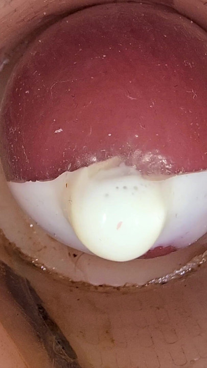 Derin amcıktaki kamera prezervatife büyük bir sperm boşalmasını kaydediyor | Klip 1
