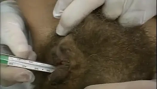 Babi tulang belakang vagina