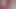 Another video about my anus, who likes, pronounced, non-standard, anuses, up close, please