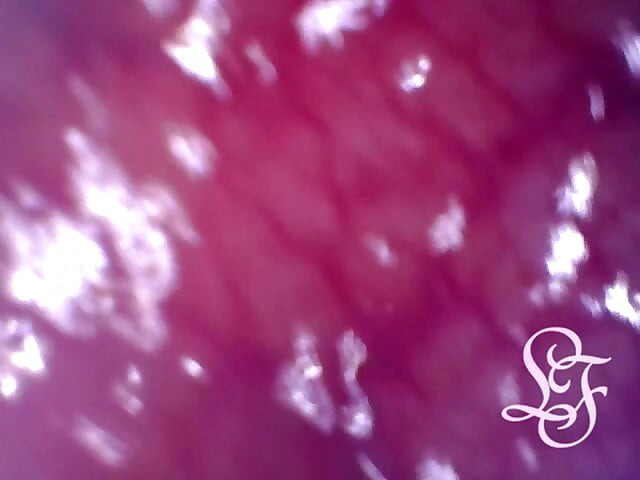 Exploring the Depths of my Ass with the Minicam!