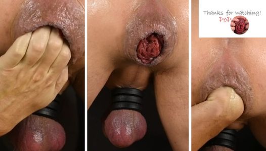 Selffist - Fisting My Horny Anal Pussy - Hard Anal Fist - Self Fist In My Asshole - Prolapse & Rosebud