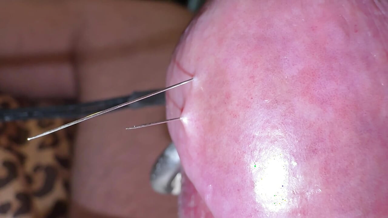 Needles through the hard glans!