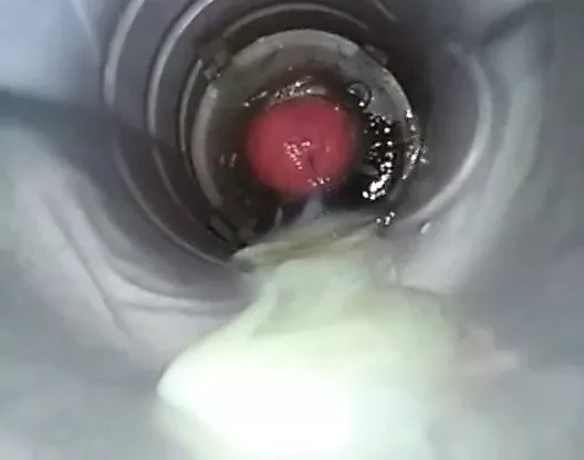 発疹の足