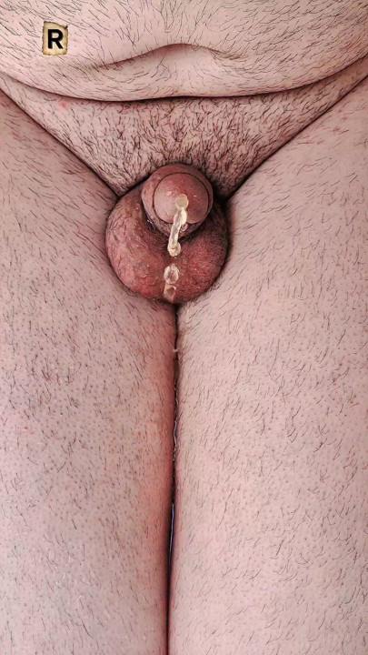 My wet penis is urinating."
