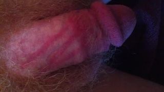 Red marks on my cock