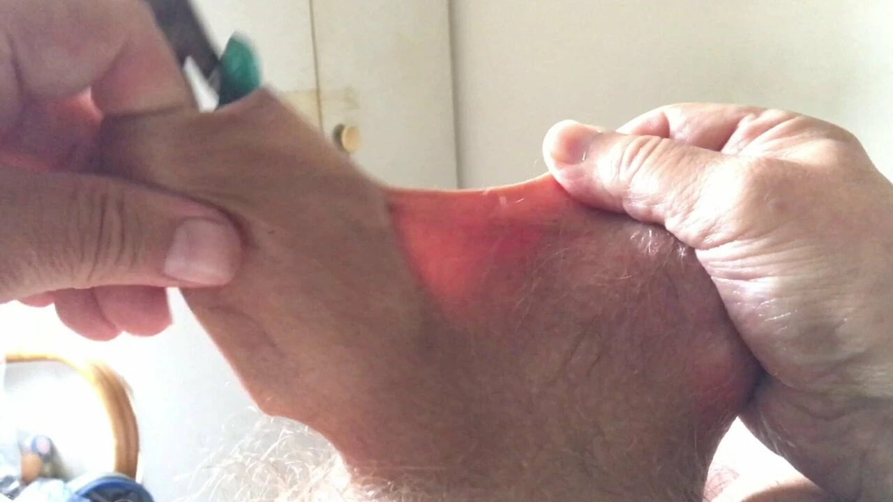 ベビーオイル包皮ビデオ-青いペンチ
