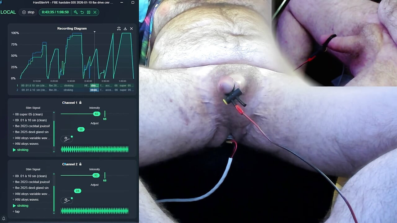 FBE Hardstim 020 سواری دیگر (الکترود متفاوت)
