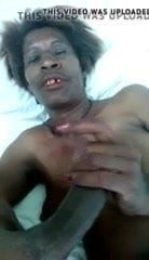 Teeth bruk mama