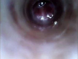 Olhe dentro do endoscópio do pau com tubo introduzindo a câmera profunda