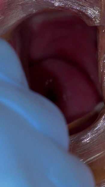 Jaw-dropping moment from "Daphne Klyde made to squirt twice in gyno chair"