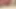 Sounding a 15-16 mm Hegar sounding rod completely