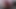 4K Fisting and Prolase Close Up