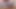 PENIS INSERTION TORTURE CLOSEUP COCK PAINFUL SCHMERZ 2