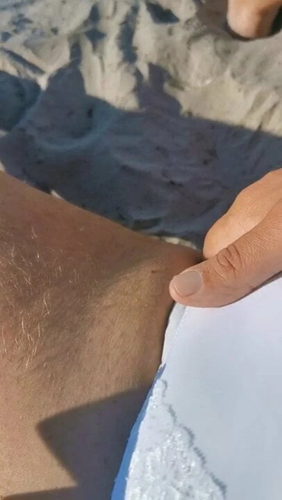 Pelenka a nyilvános strandon