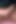 Intrusive Thoughts Lead Me to Masturbate at Home When the Visitor Is Here