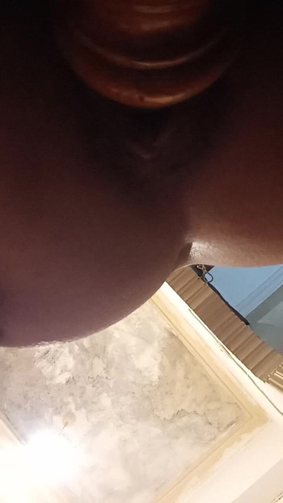Moja guza