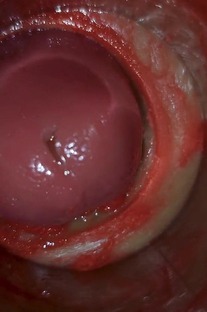 Kamera Unutar Duboke Pičke Snima Ogromnu Ejakulaciju Sperme Asmr