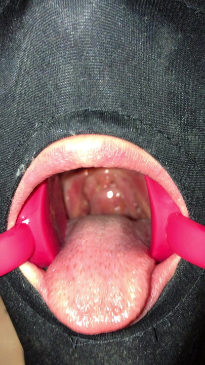 Fickloch 1