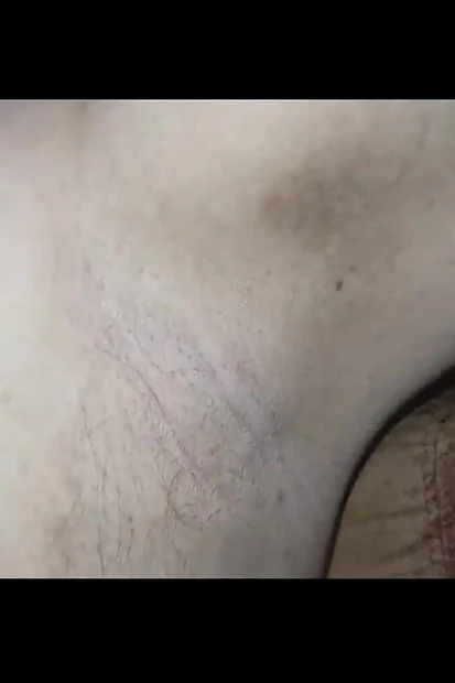 Armpit 2