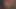 浣腸中断1