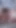 Jaw-dropping moment from "ONLYPERVS - AMATEUR GRANNY PORN: 80 YEARS OLD GRANDMA ANAL SEX CREAMPIE CAM2 2of5"