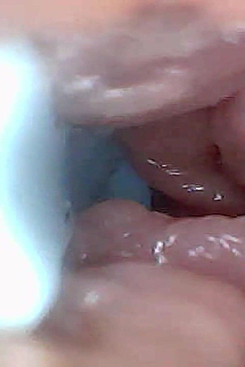 Visual Guide to G-spot Stimulation and Orgasm Endoscop Perspective