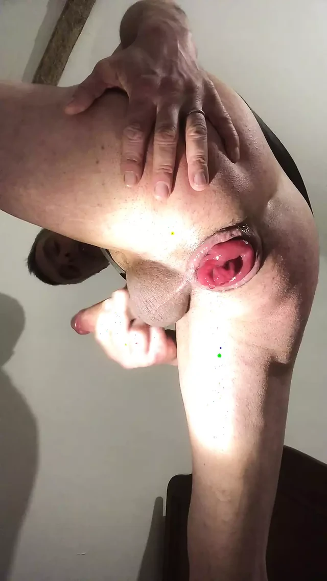 he exposes his destroyed anal