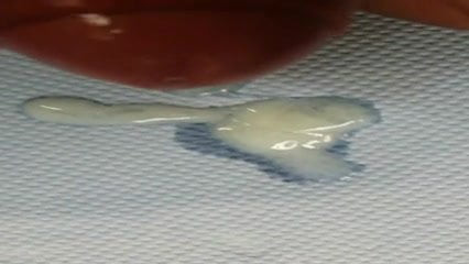 Abspritzen 1