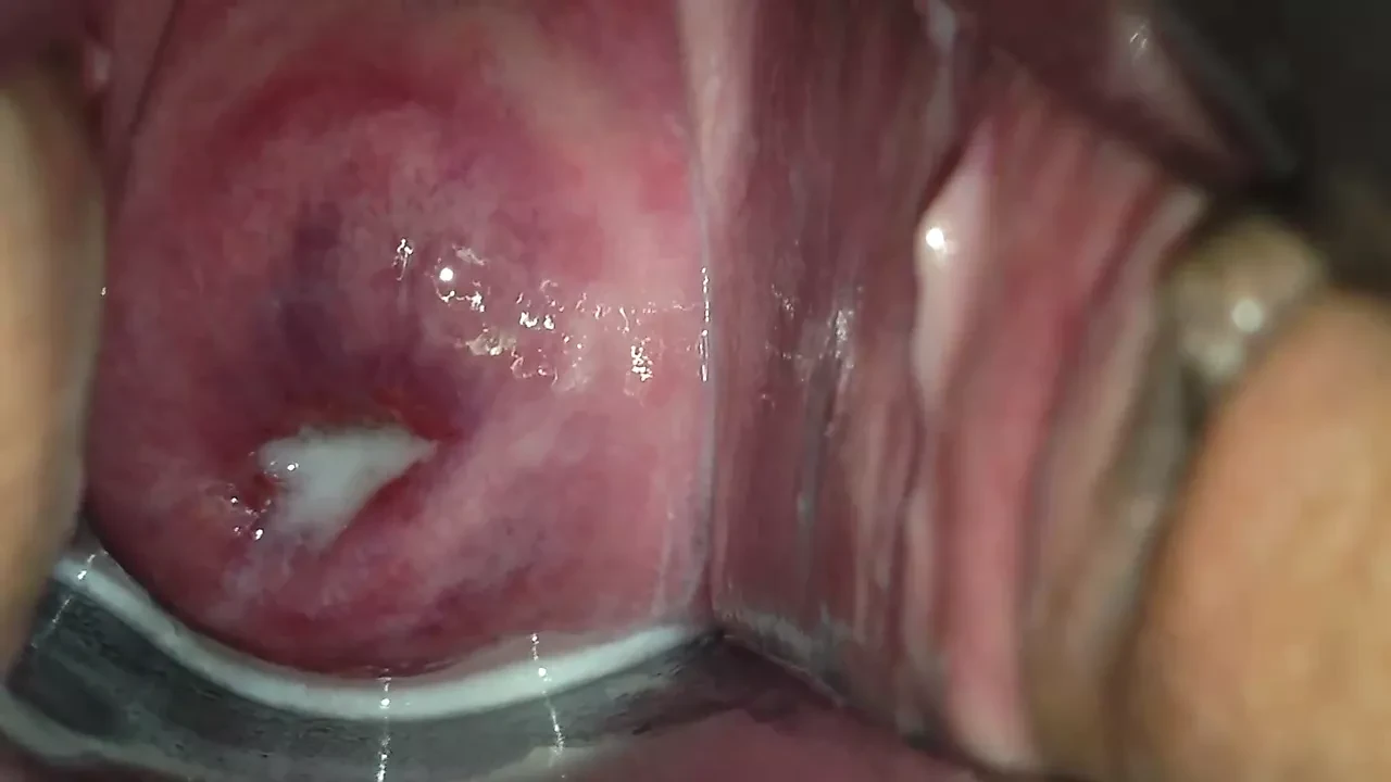 cervix