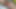 ビブロズンゲと膣