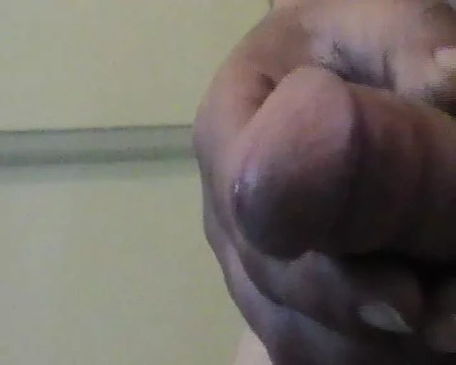 Abspritzen1