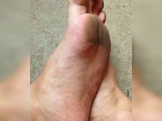 Meine schmutzigen Fußsohlen (Diashow)