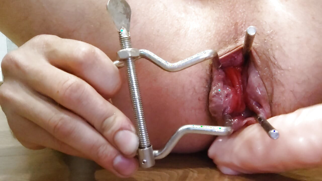 Anal,fisting,extension