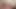 DP