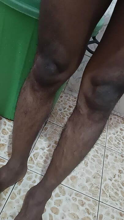 털이 무성한 후장